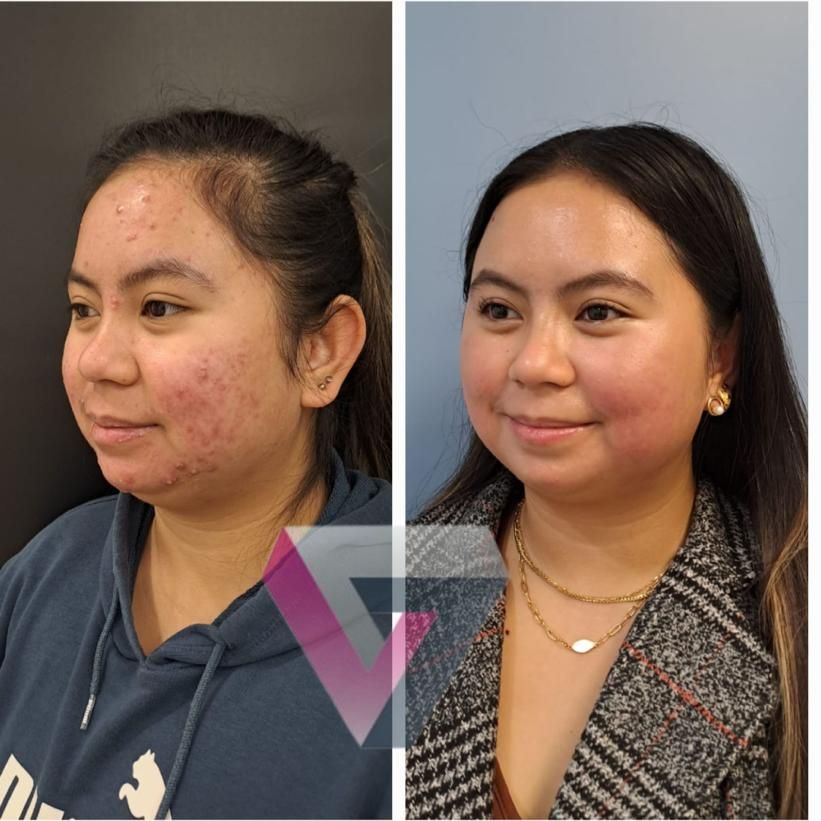 Victoria Trasmonte-110