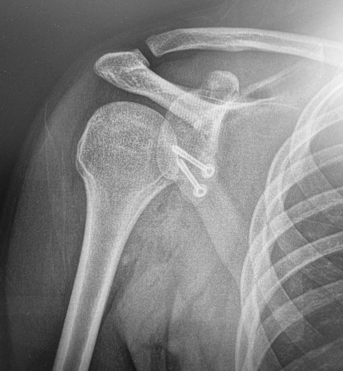 Daniele Passaretti-26