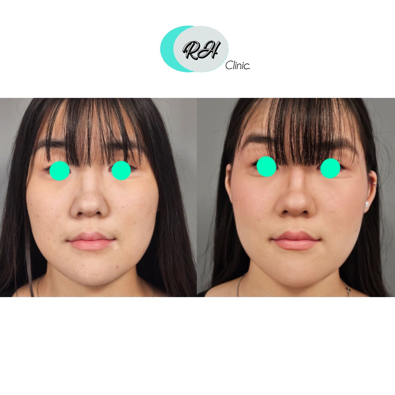 Rosalba Herrero Zerpa-622