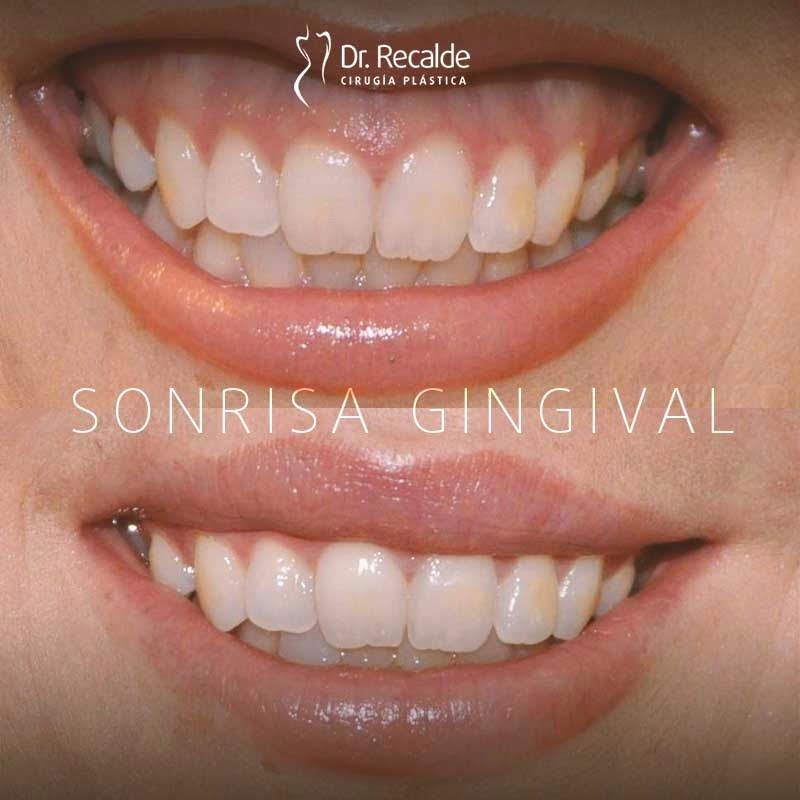 César Recalde Losada-0