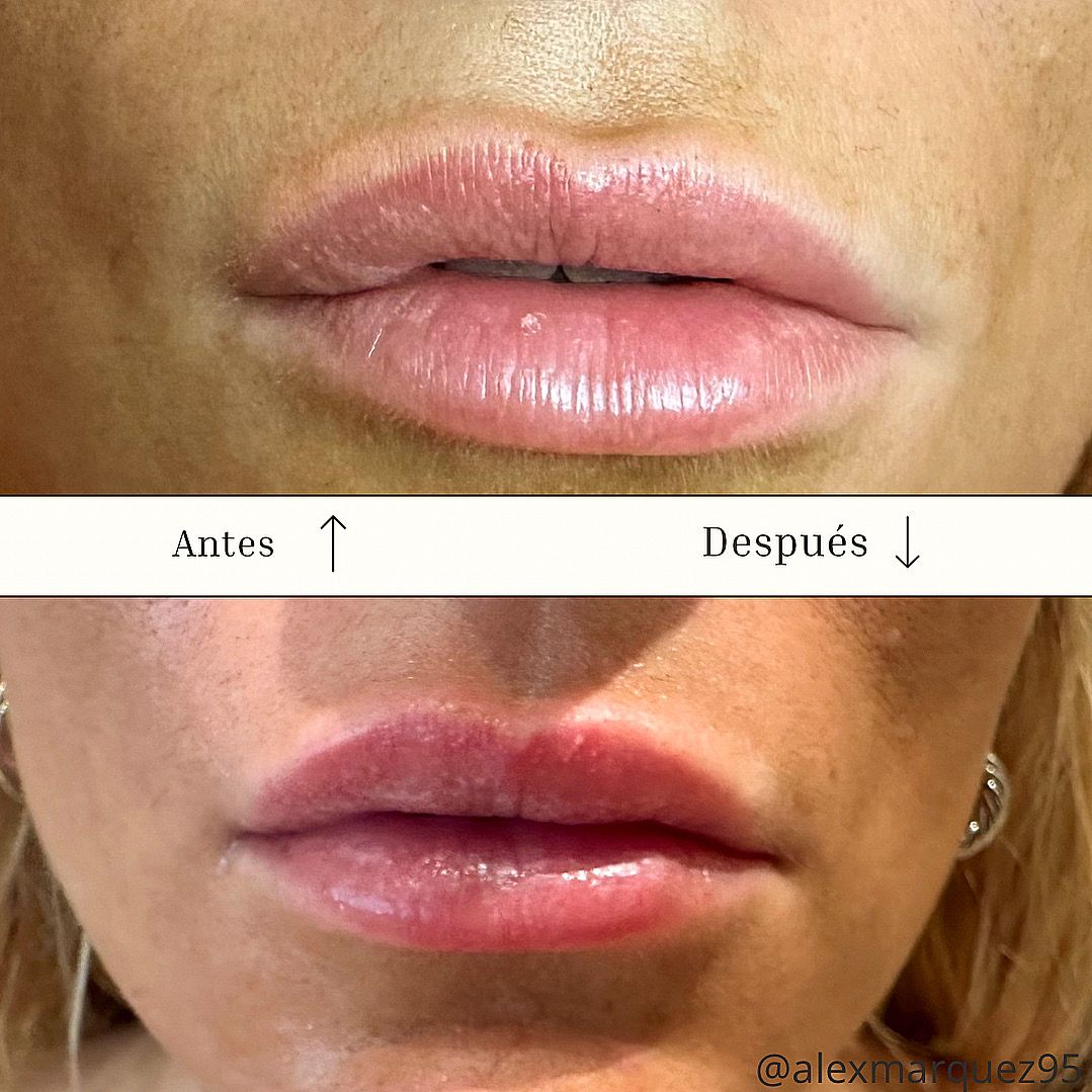 Alejandro Márquez Coloma-3