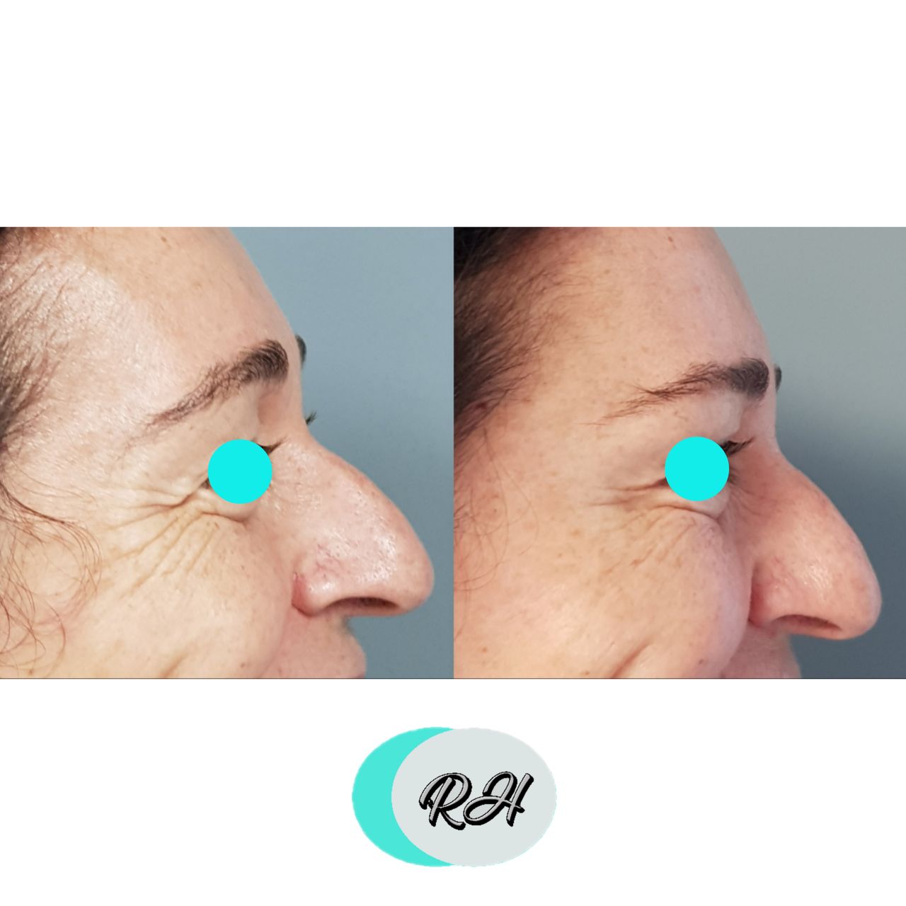 Rosalba Herrero Zerpa-146