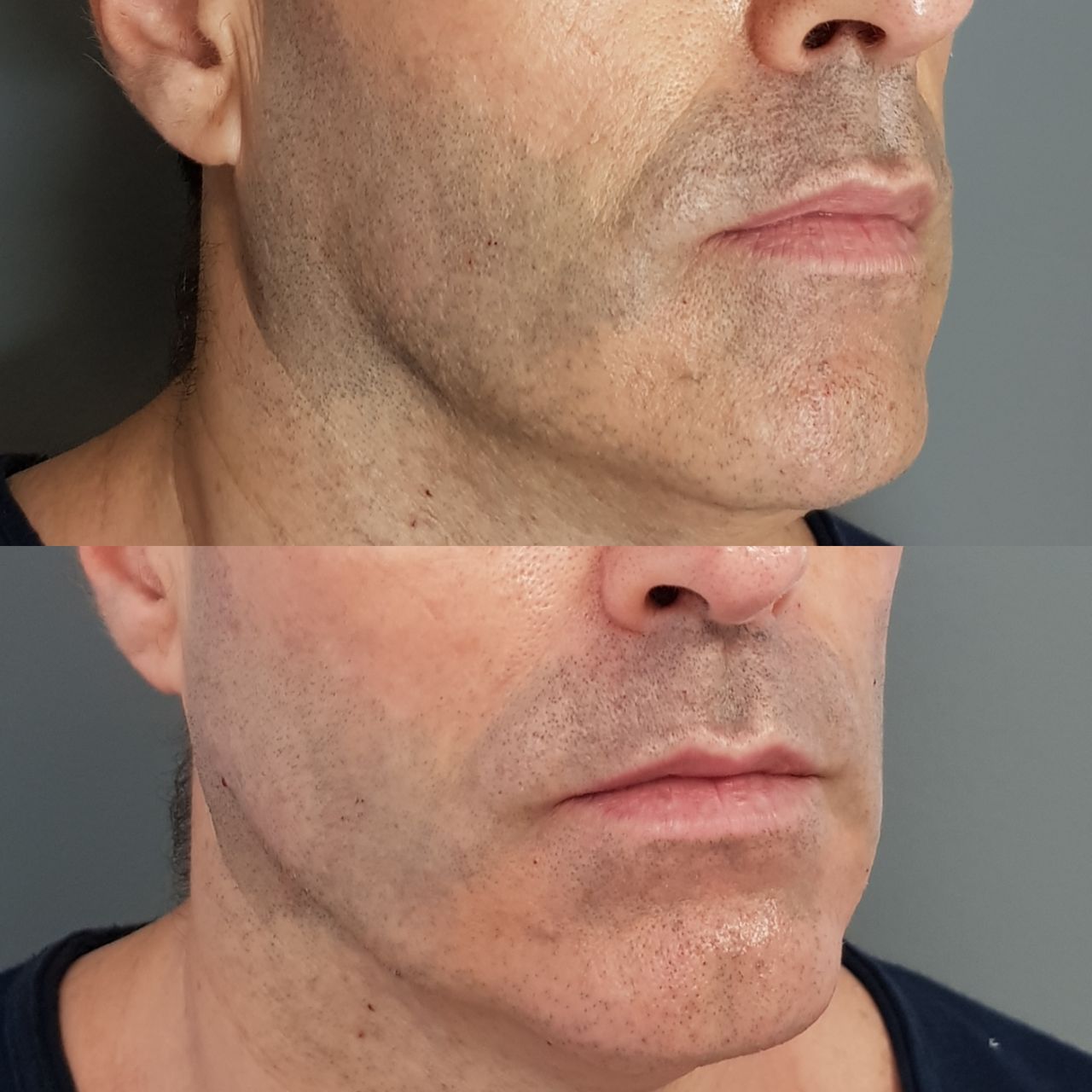 Rosalba Herrero Zerpa-253