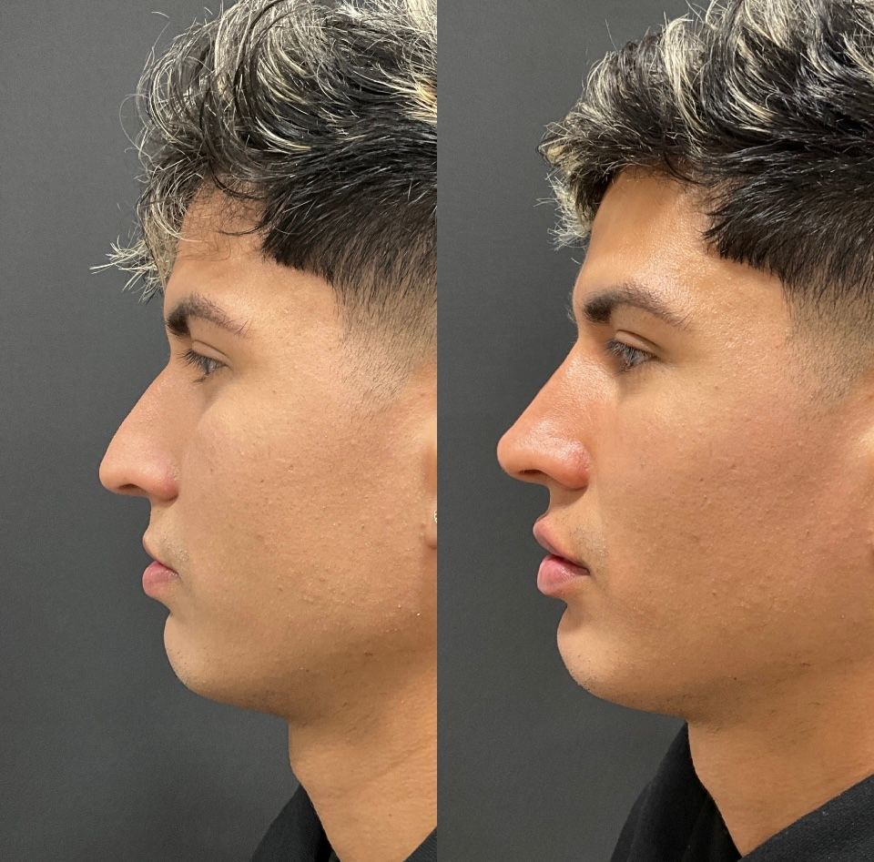 Raffaele Del Prete-9