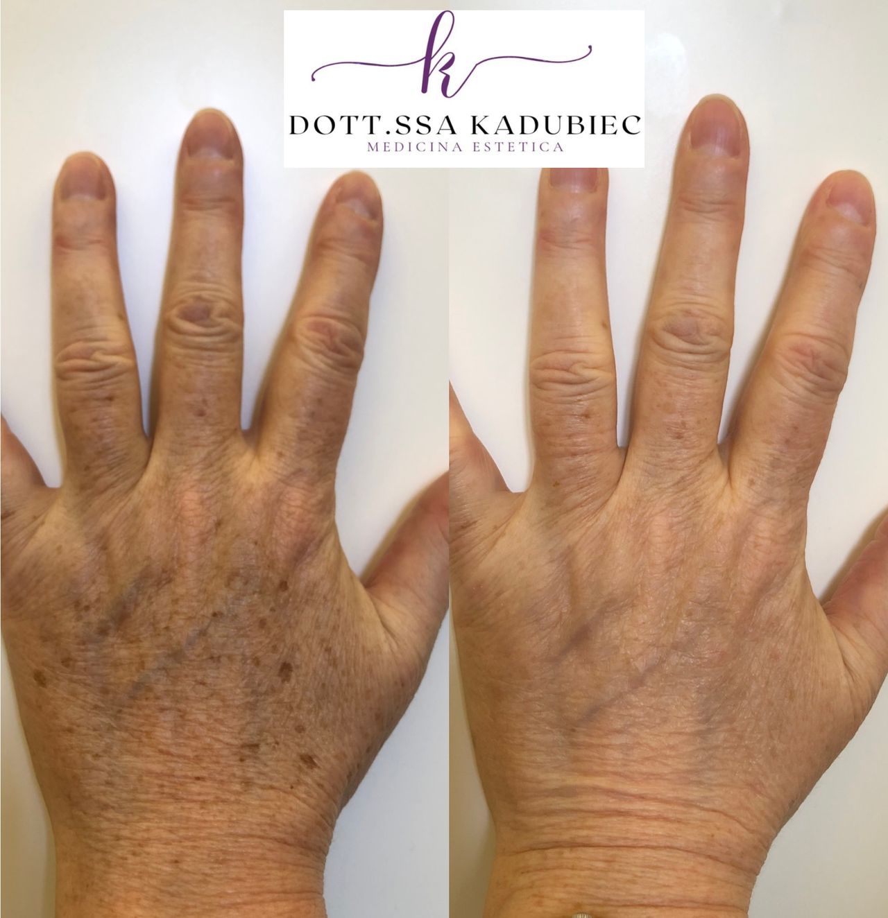 Aleksandra Kadubiec-22