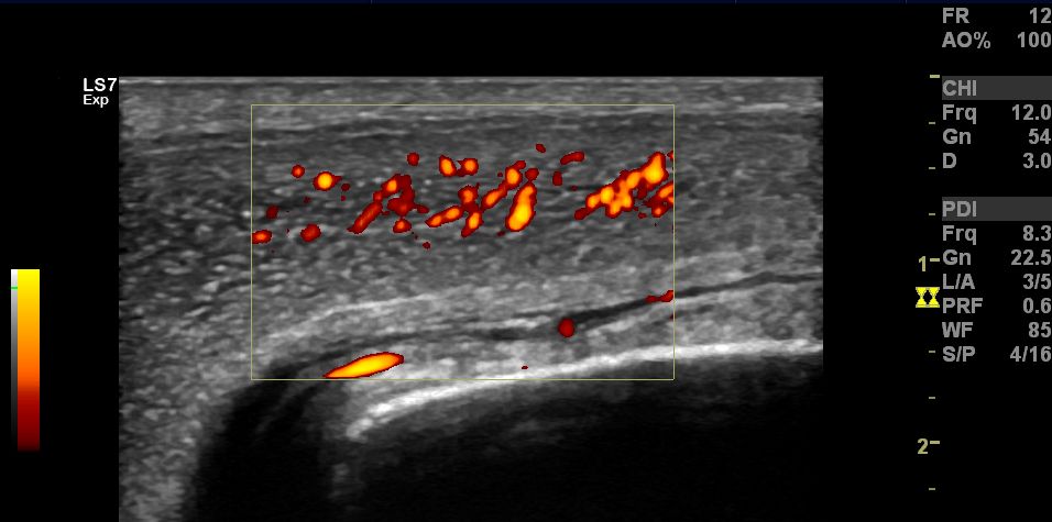 Andrzej Krzysztof Przybyła-11