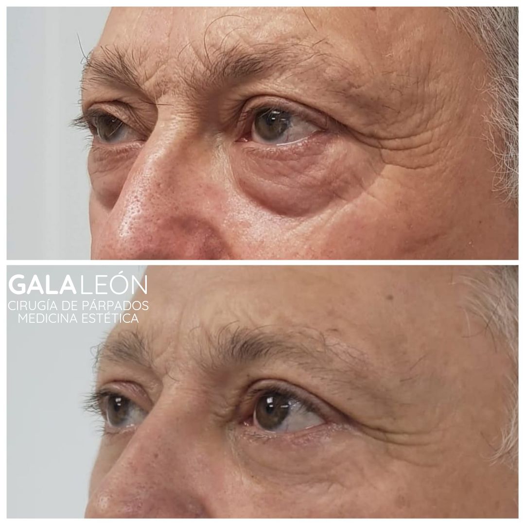 Gala P. Leon Salvatierra-17