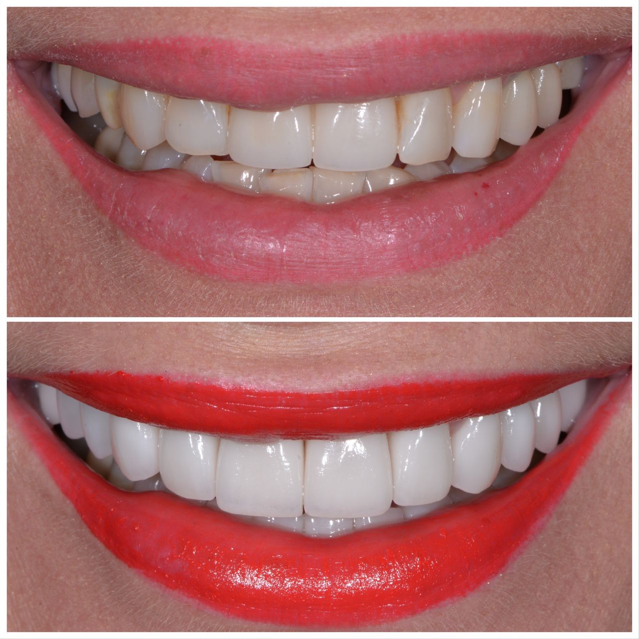 Martin Bartoszcze-42