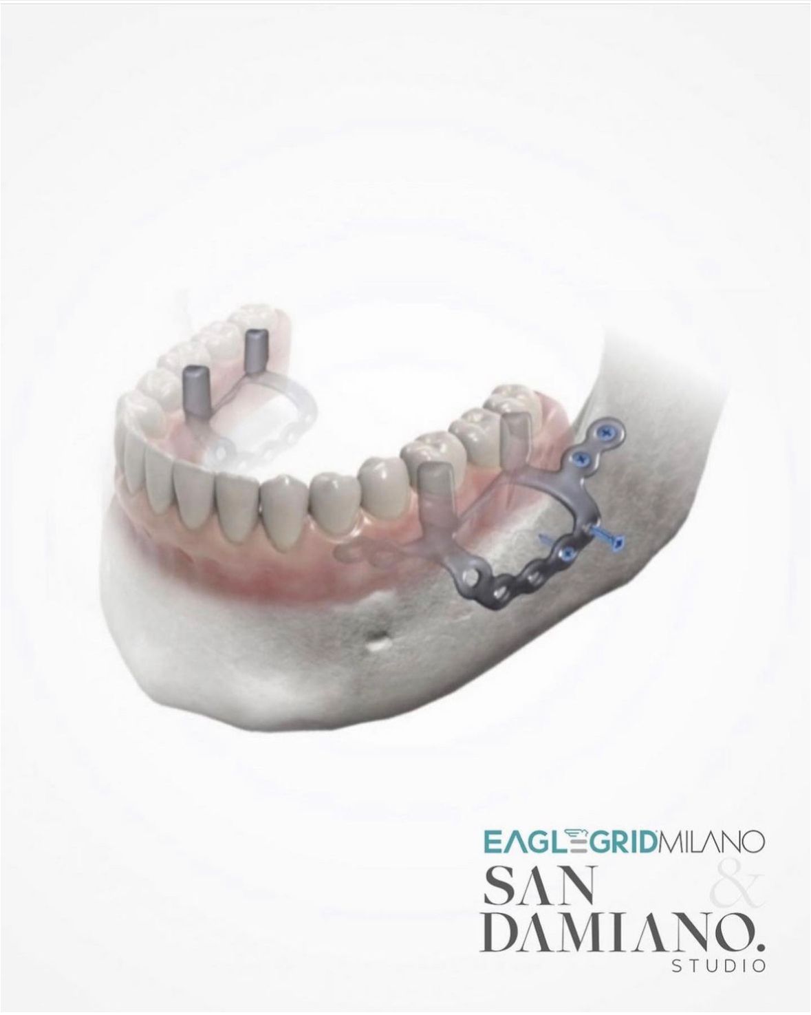 Alessandro Sorrenti-4