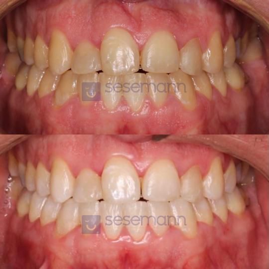 Paula Cano Carrillo-50