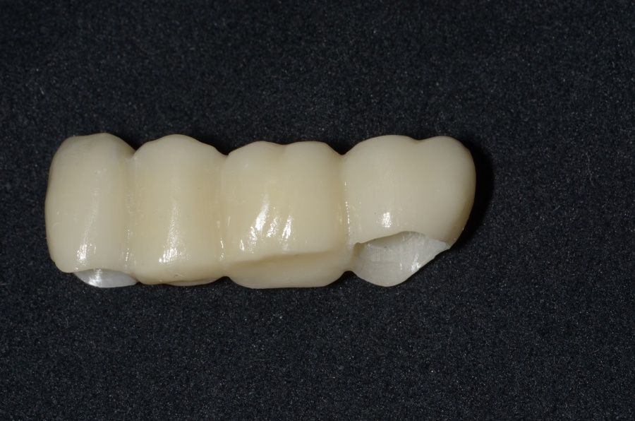 Berthold Kratzenstein-7