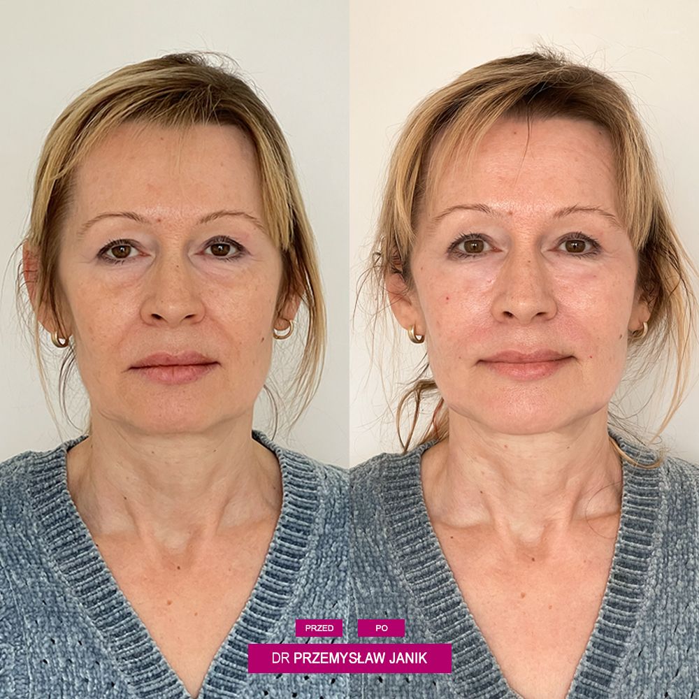 Przemysław Janik-32