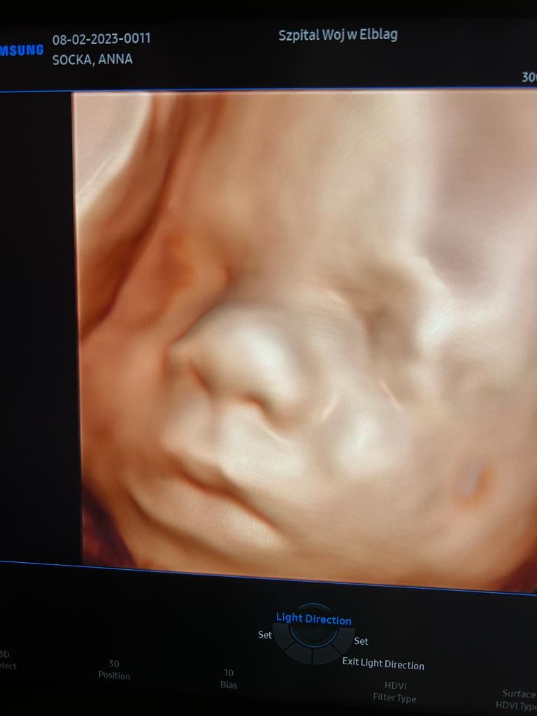 Izabela Macinkiewicz-11