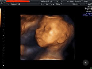 José Antonio Navarro Repiso-7