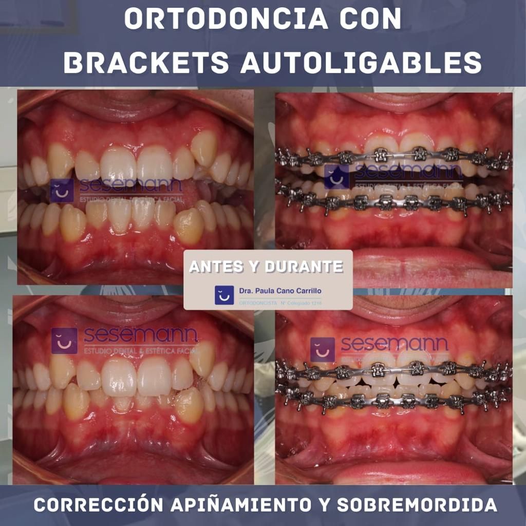 Paula Cano Carrillo-14