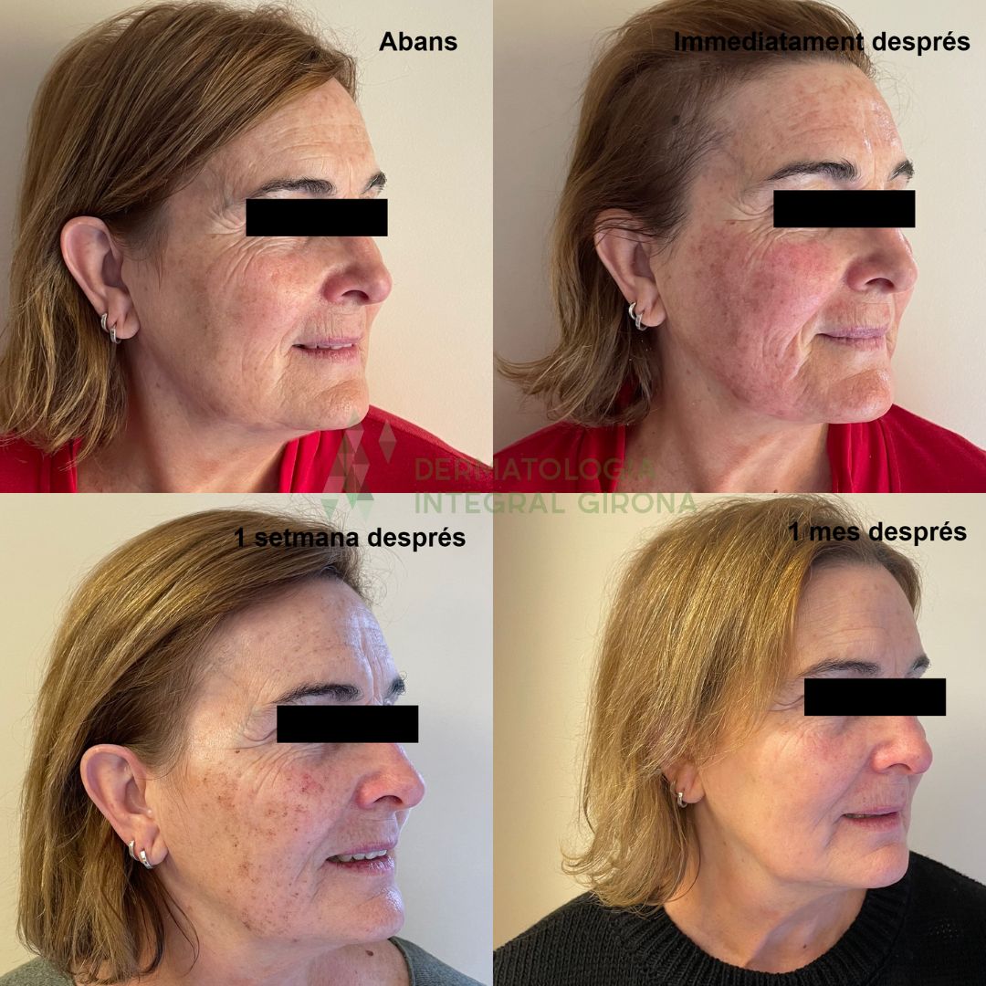 Maria Damont Serra-1