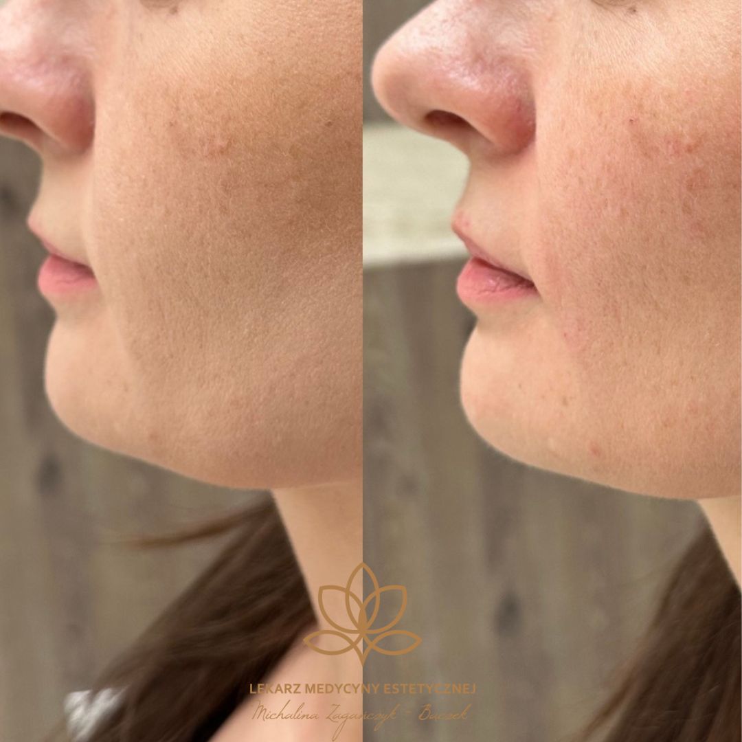 Michalina Zagańczyk-Bączek-45