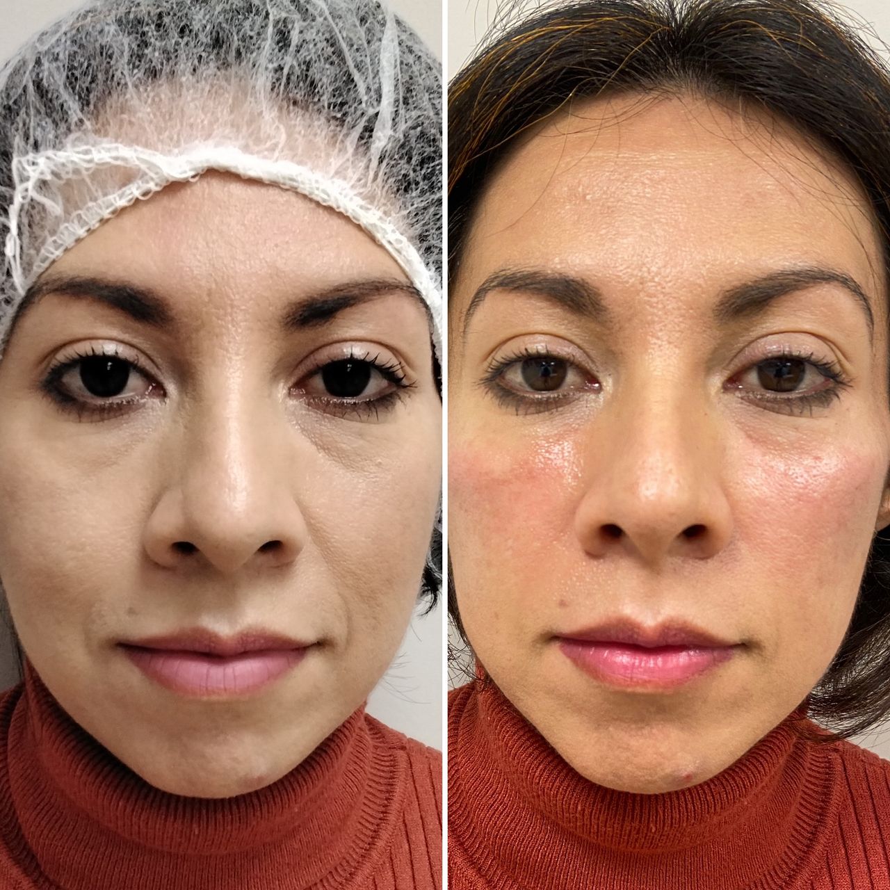 Javier Ribelles Alfonso-10