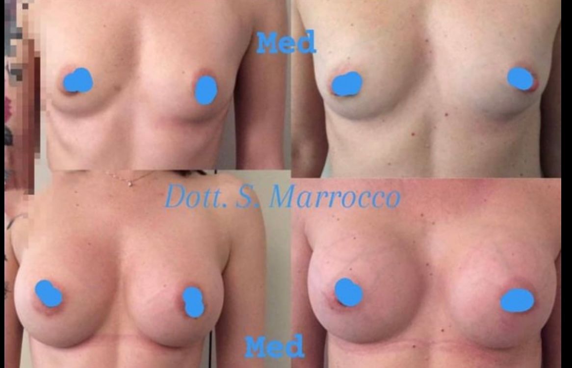 Salvatore Marrocco-1