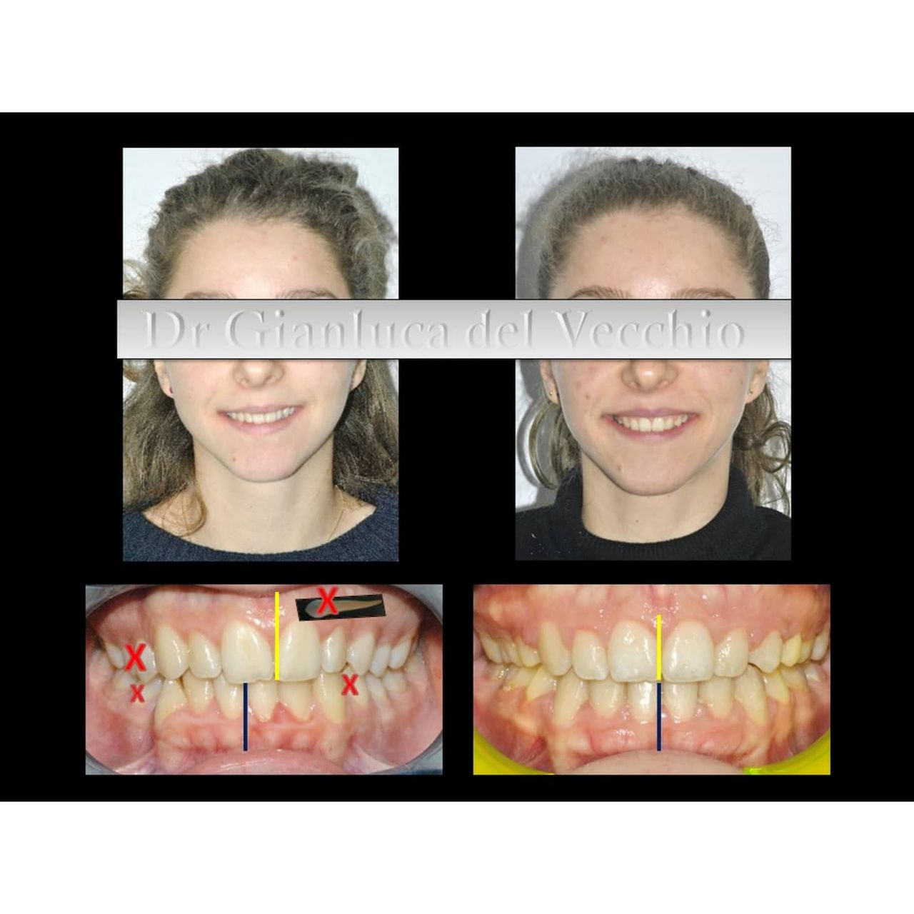 Gianluca Del Vecchio-87