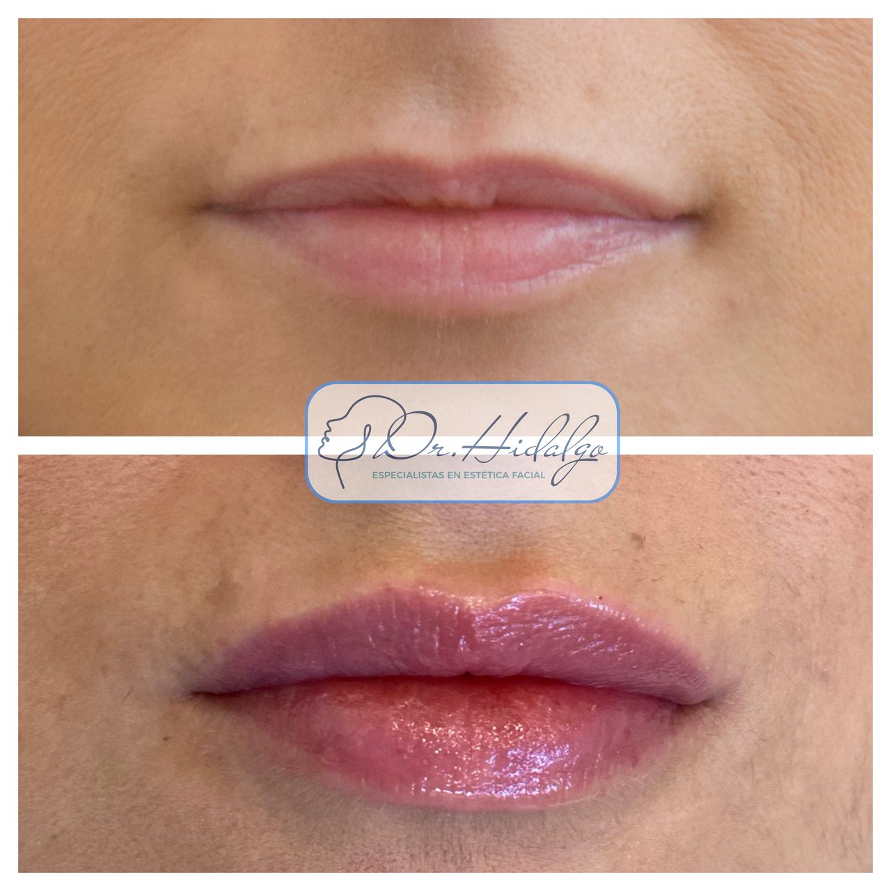 Víctor Hidalgo López-4