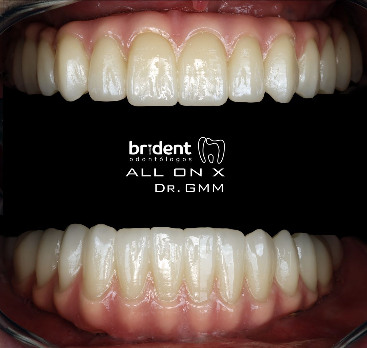 Guillermo Moreno Masiá-77