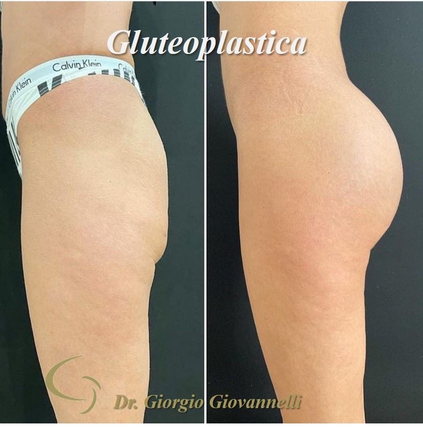 Giorgio Giovannelli-59