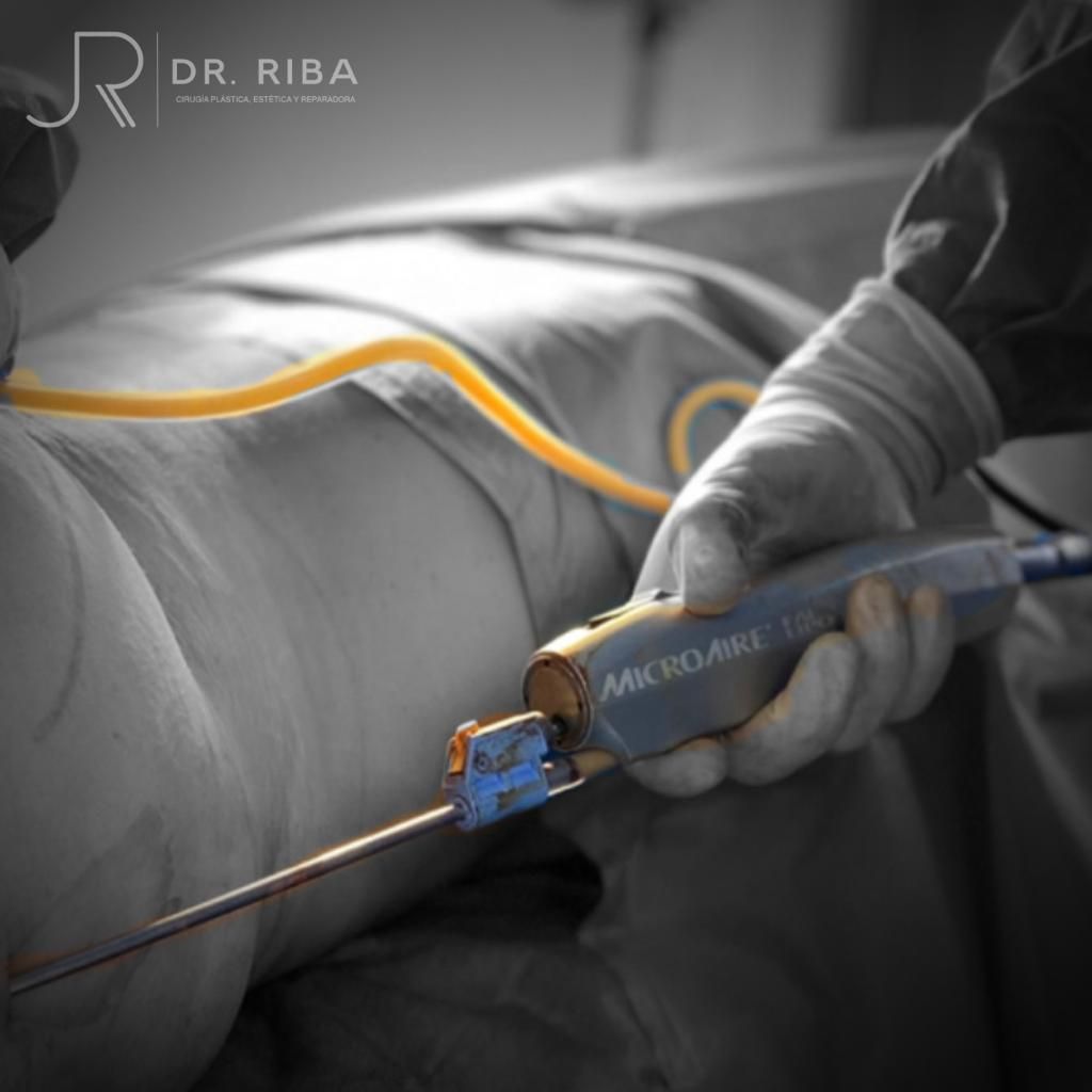 Jordi Riba Vilchez-68