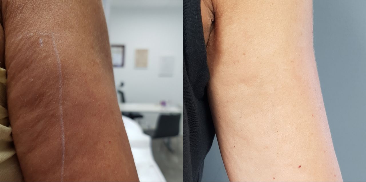 Rosalba Herrero Zerpa-134