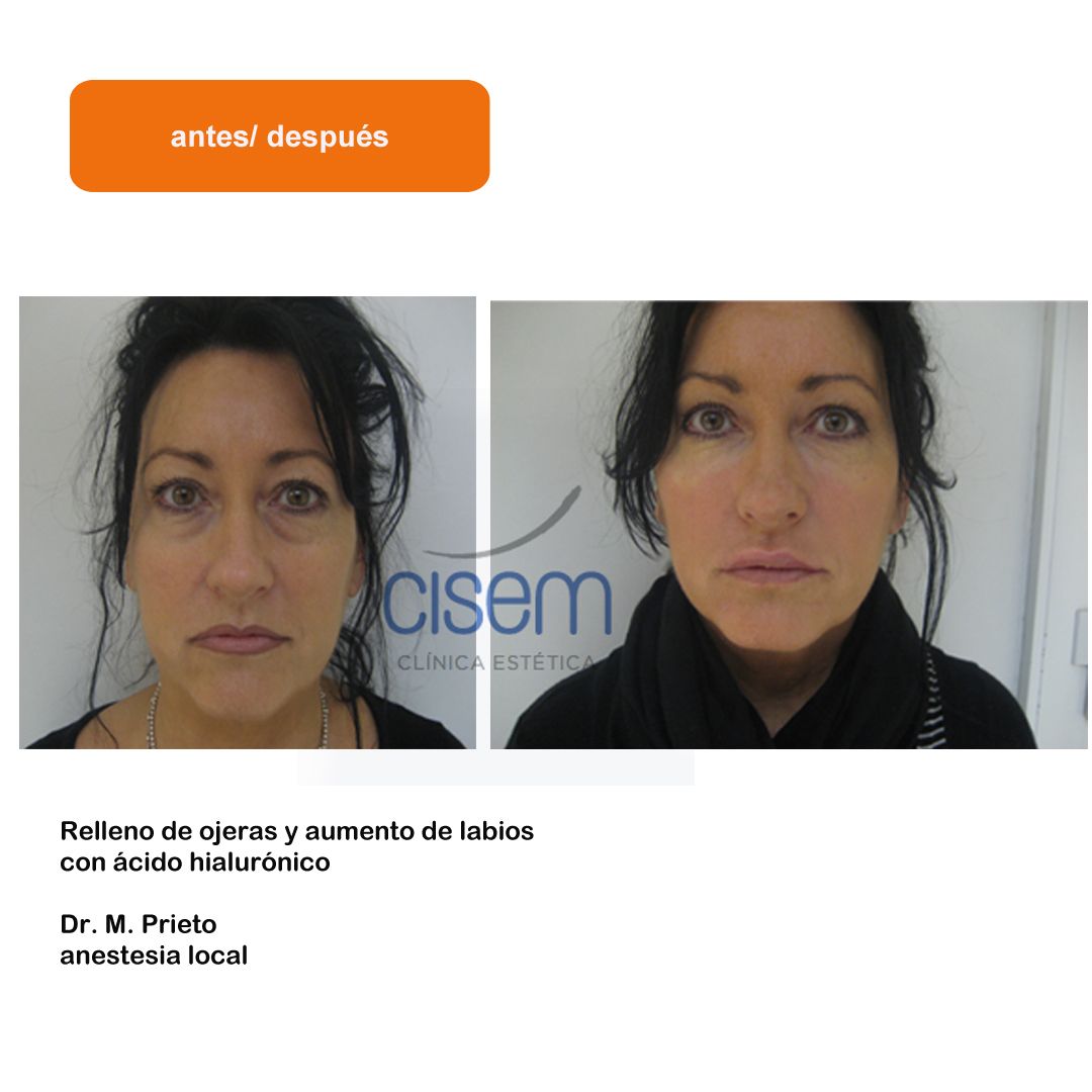 Manuel Prieto Pérez-27