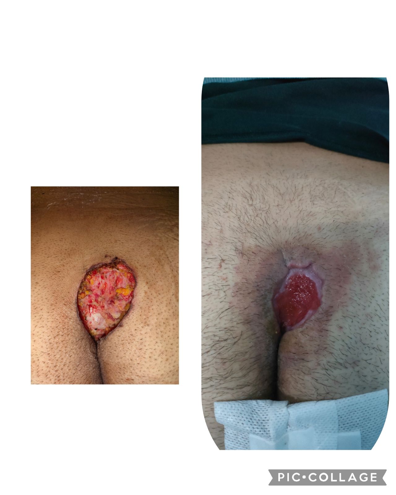 Francesco Rinaldi-25