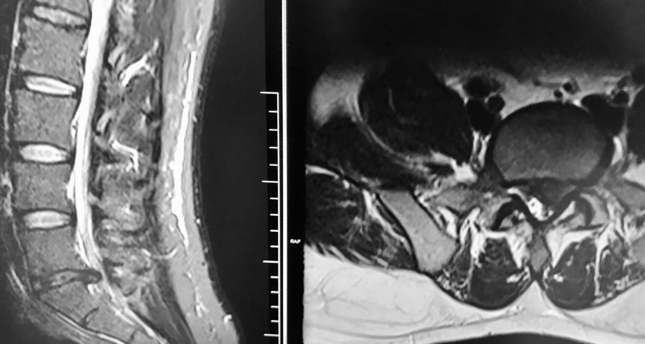 Juan Camilo Hernandez Acevedo-7