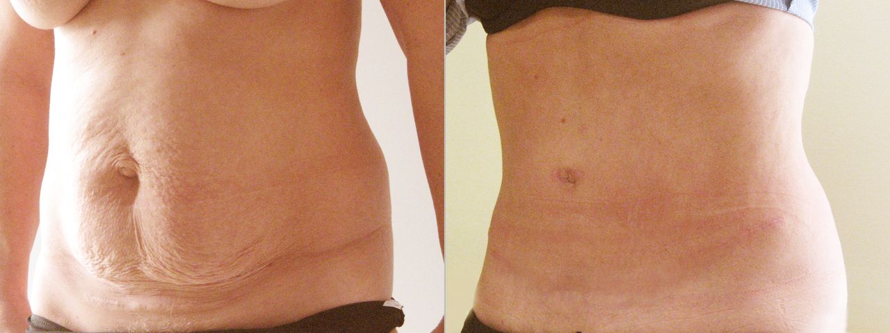 Małgorzata Keller-Skomska-2