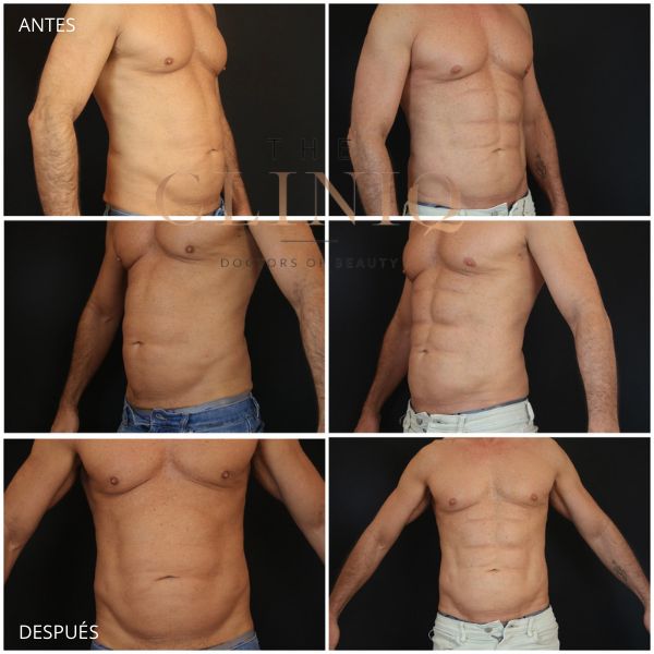 Ricardo Coronel Gagliardi-8