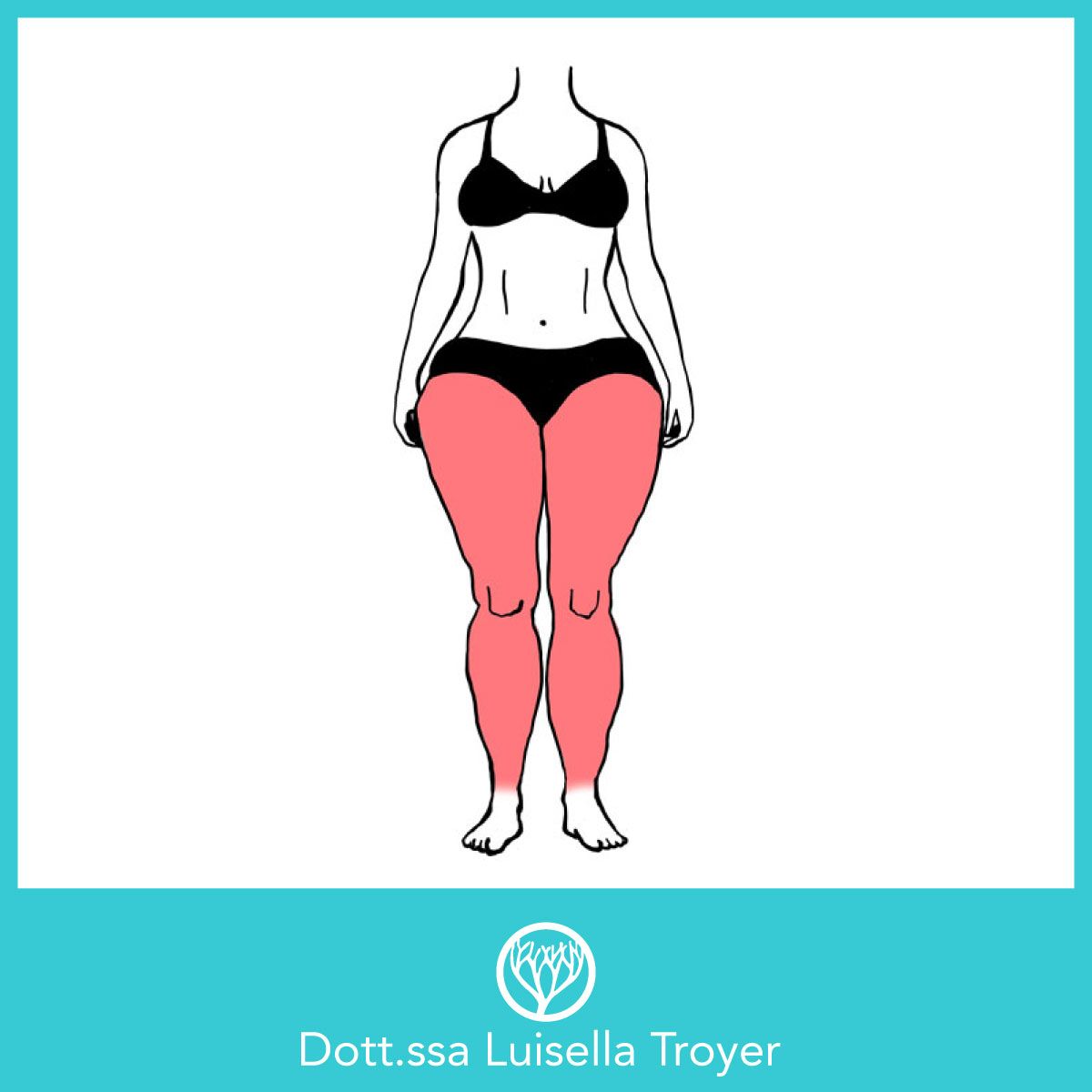 Luisella Troyer-0