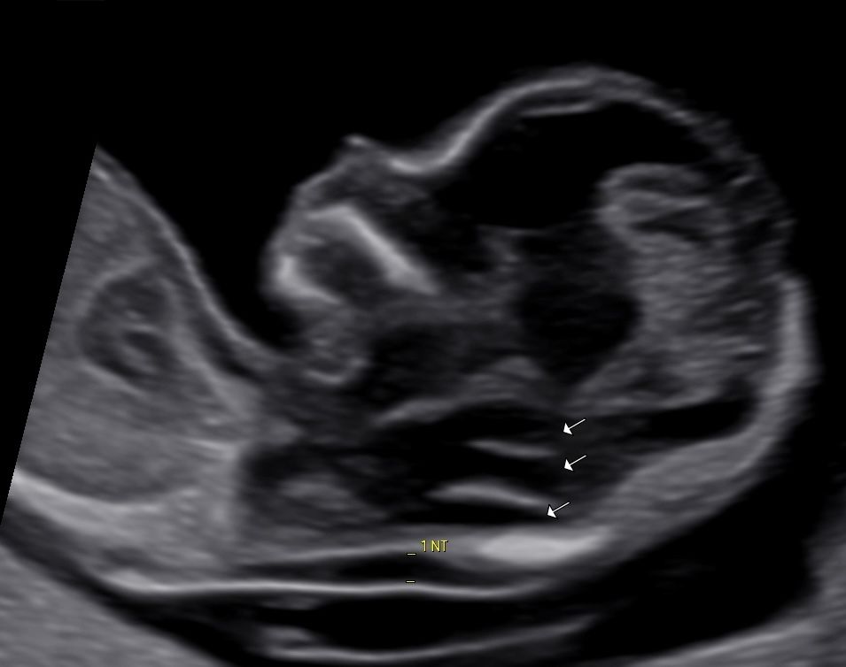 Serena  Lucarelli -0