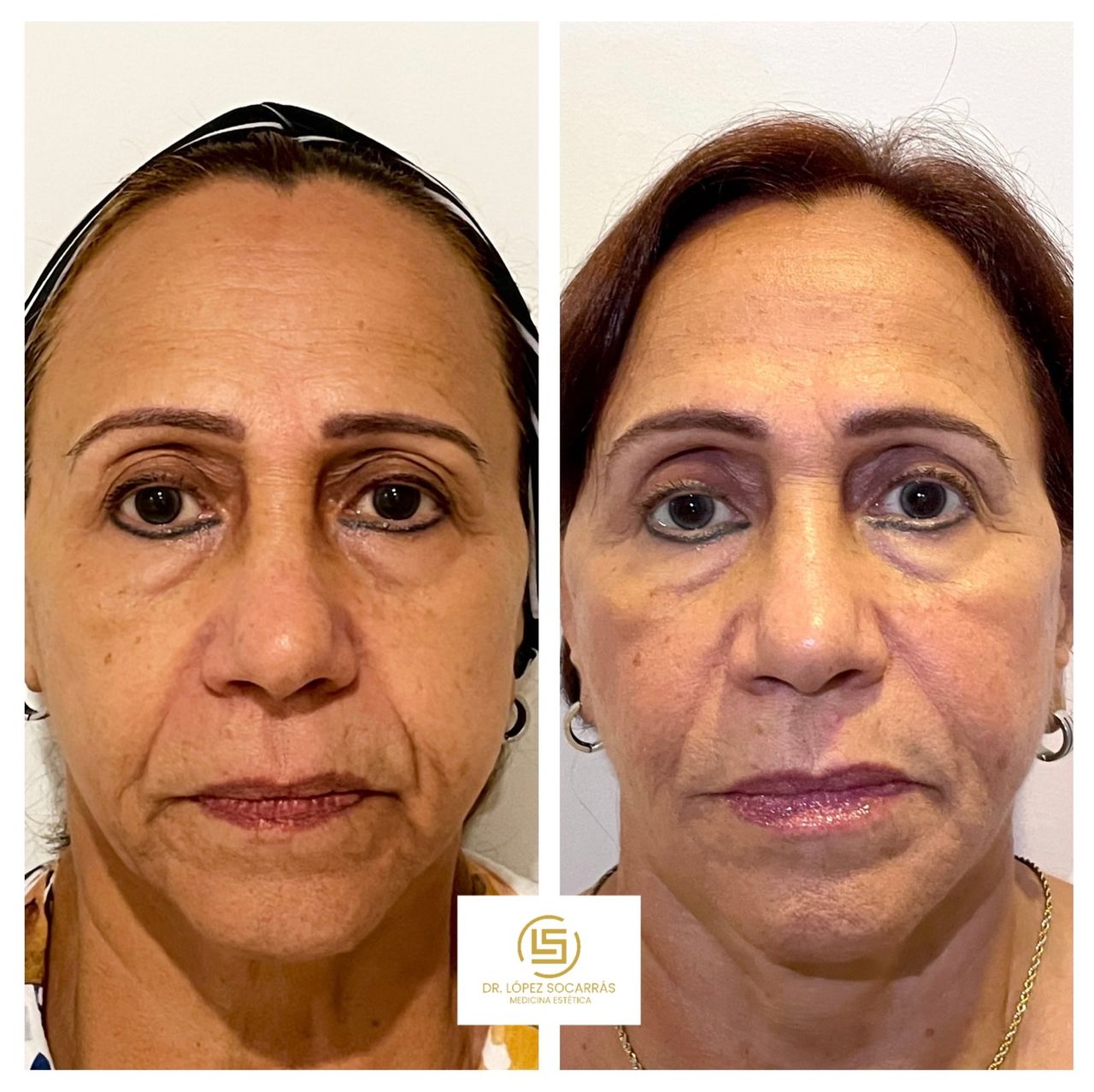 Camilo López Socarrás-13