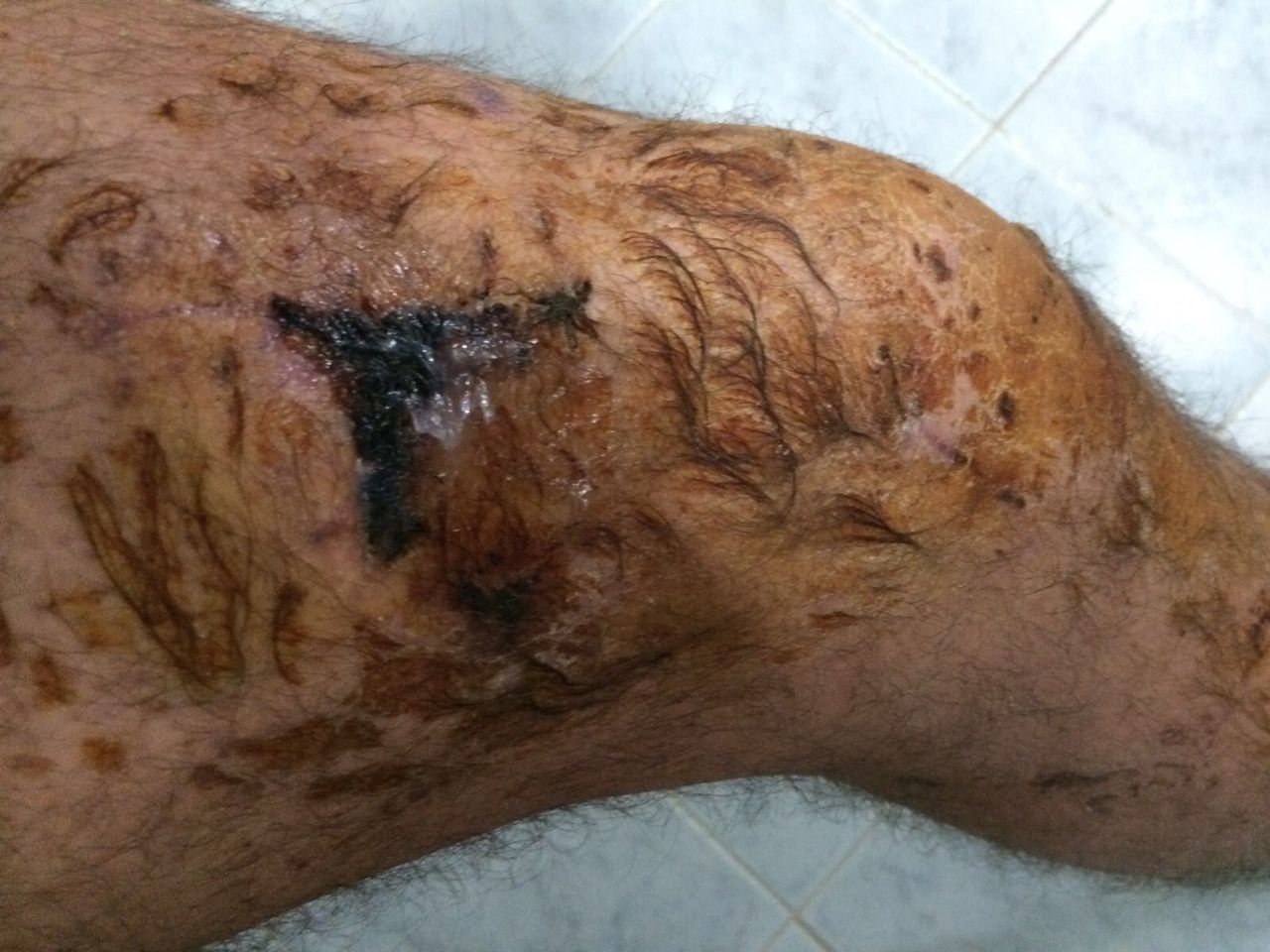 Giuseppe Lombardo-31