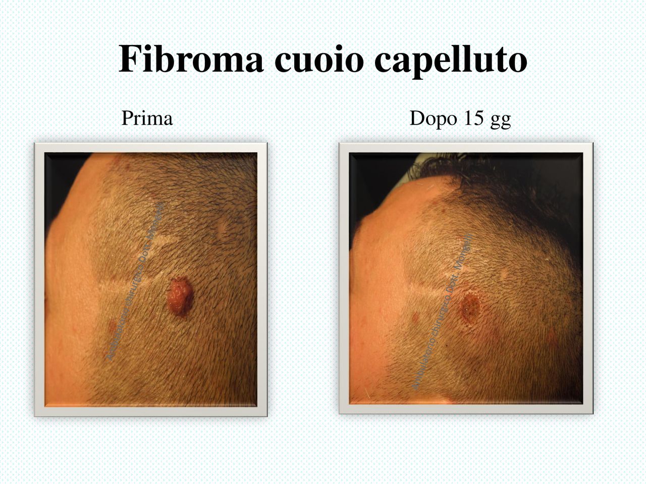 Matteo Antonio Mongelli-3