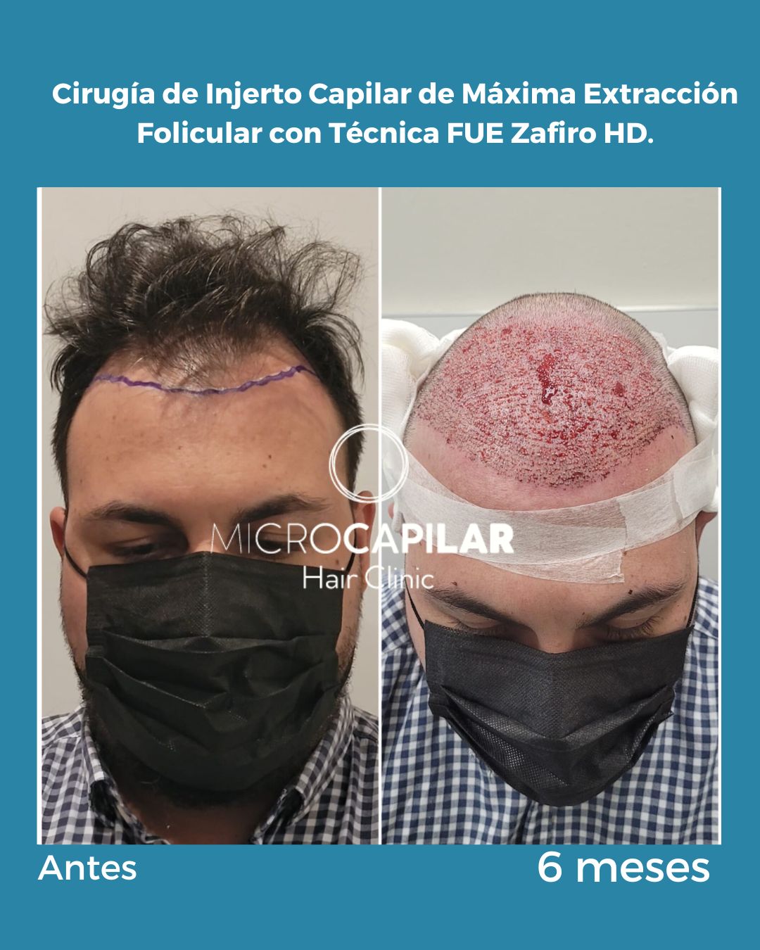 Uraima Argotty Rodríguez-4