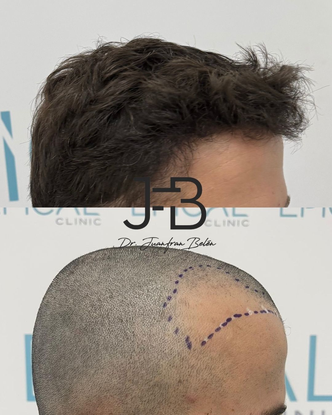 Juan Francisco Belén Montero-5