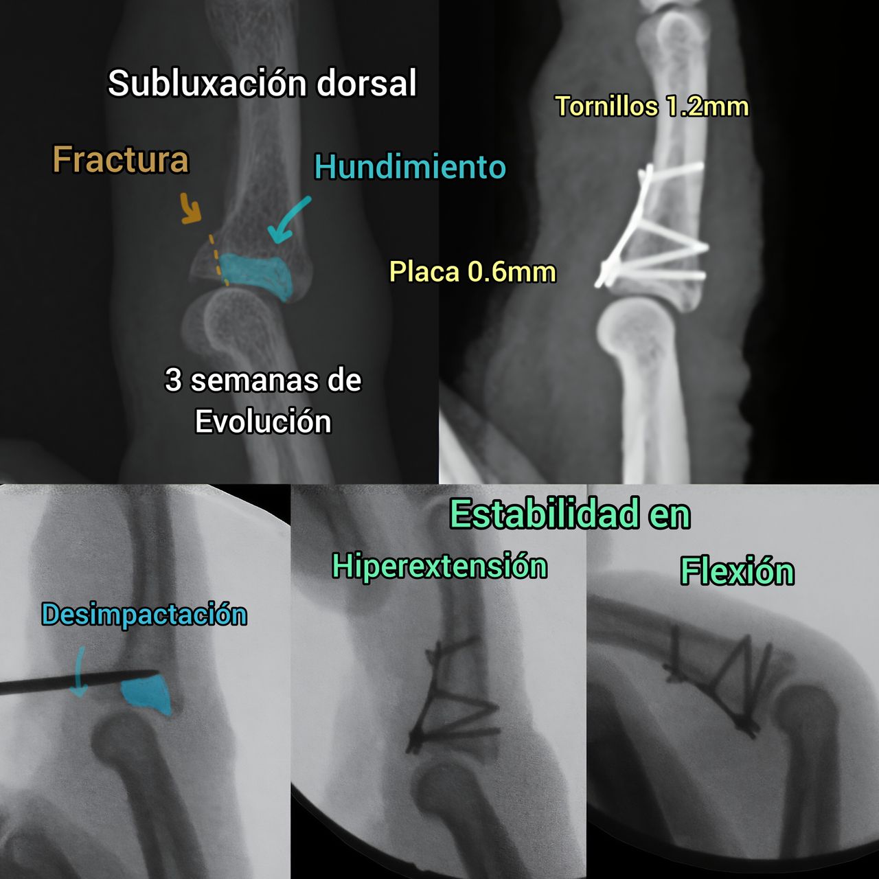 Derlis Sotelo García-11
