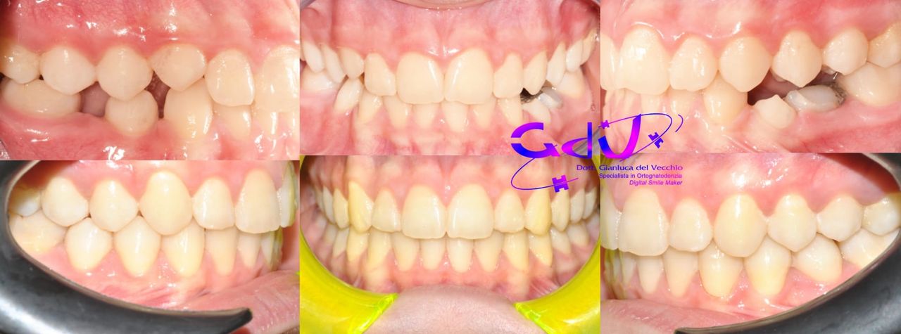 Gianluca Del Vecchio-178