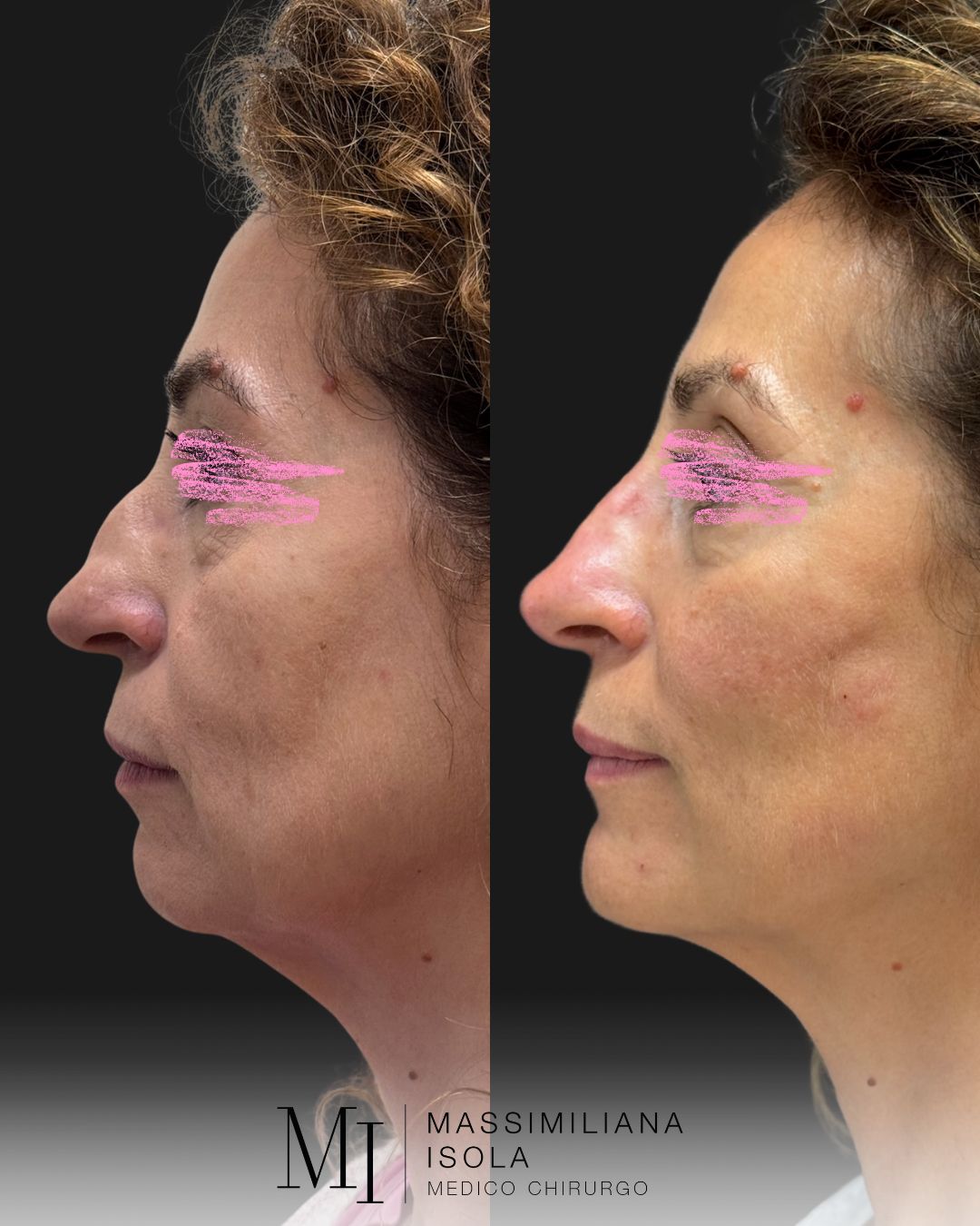 Massimiliana Isola-0