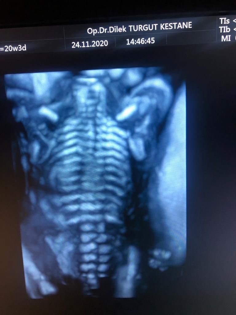 Dilek Turğut Kestane-3