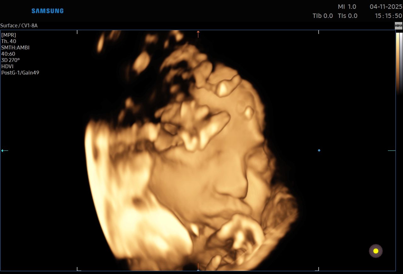 Valentina Del Negro-8