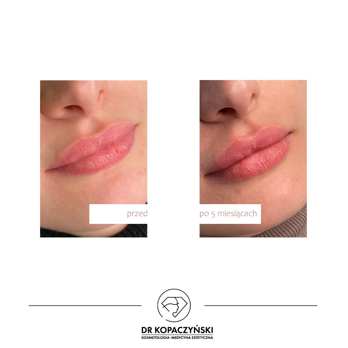 Jakub Kopaczyński-4