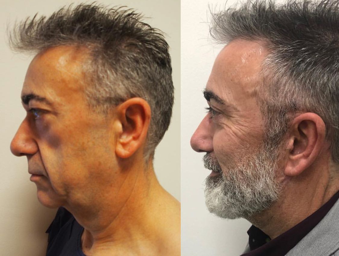 Alberto Candau Álvarez-37