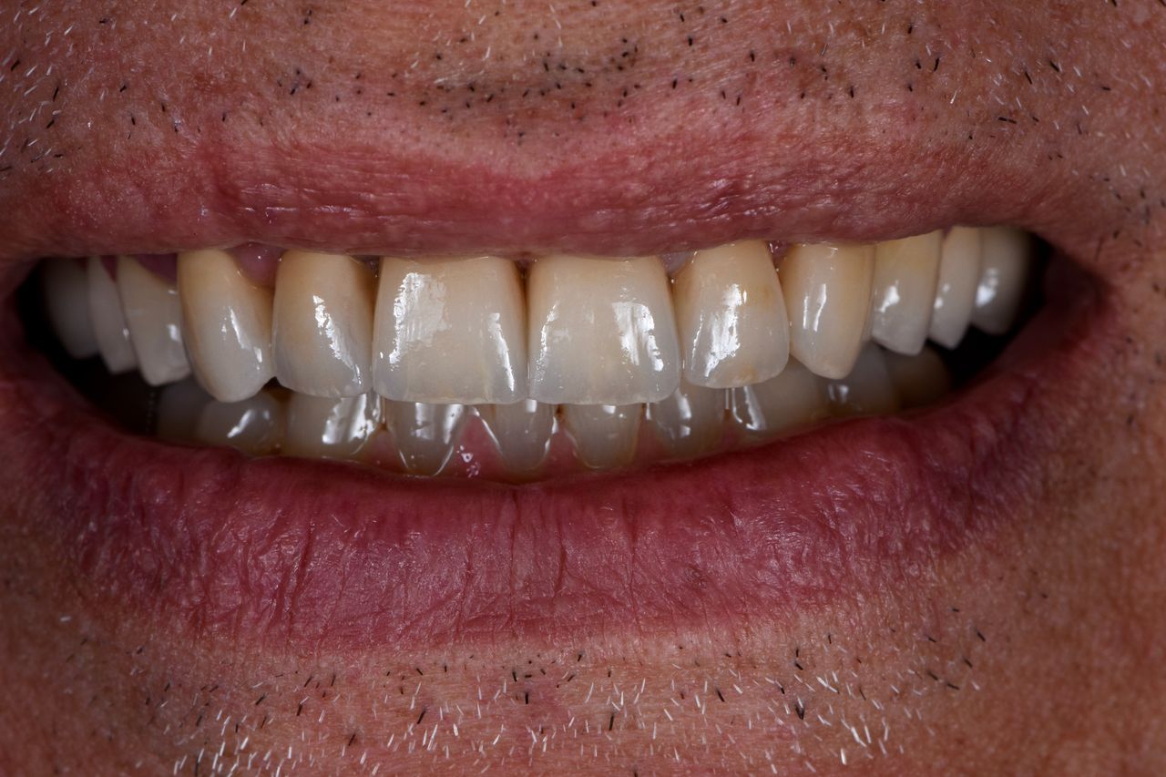 Riccardo Giardina-12