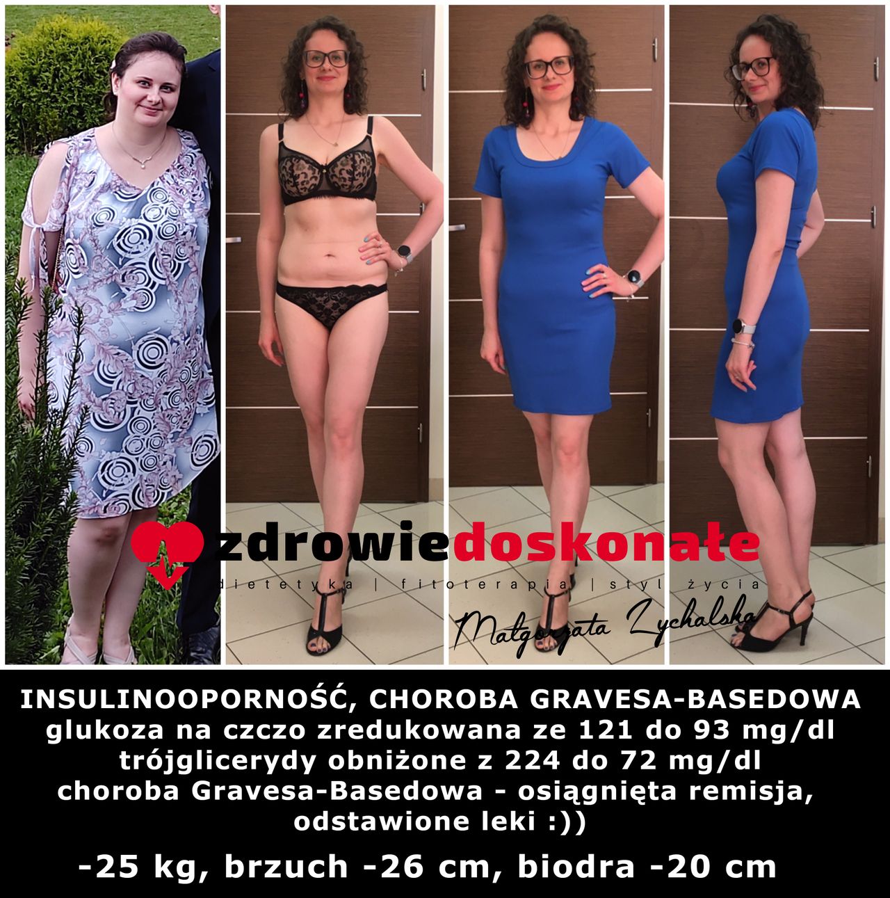 Małgorzata Zychalska-60